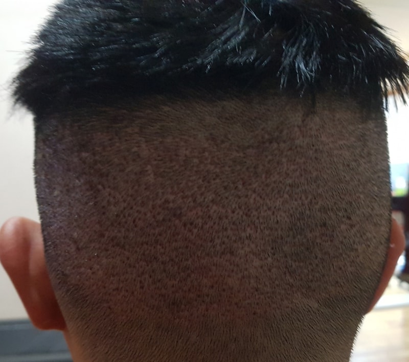 수술다음날.jpg
