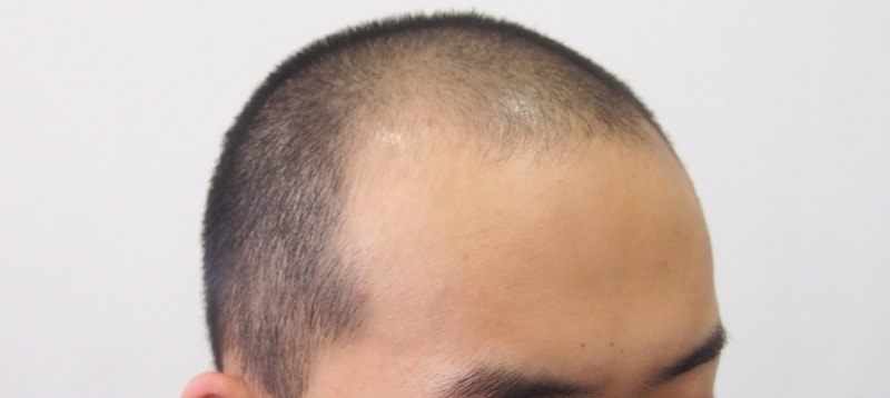 수술 전3.jpg