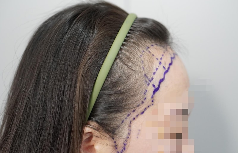 BeautyPlus_20240309130231034_save.jpg