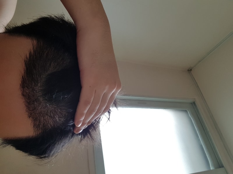 수술후 위.jpg
