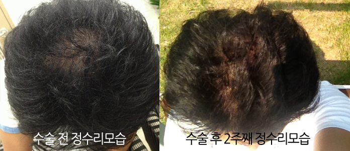 수술전후모습비교.jpg