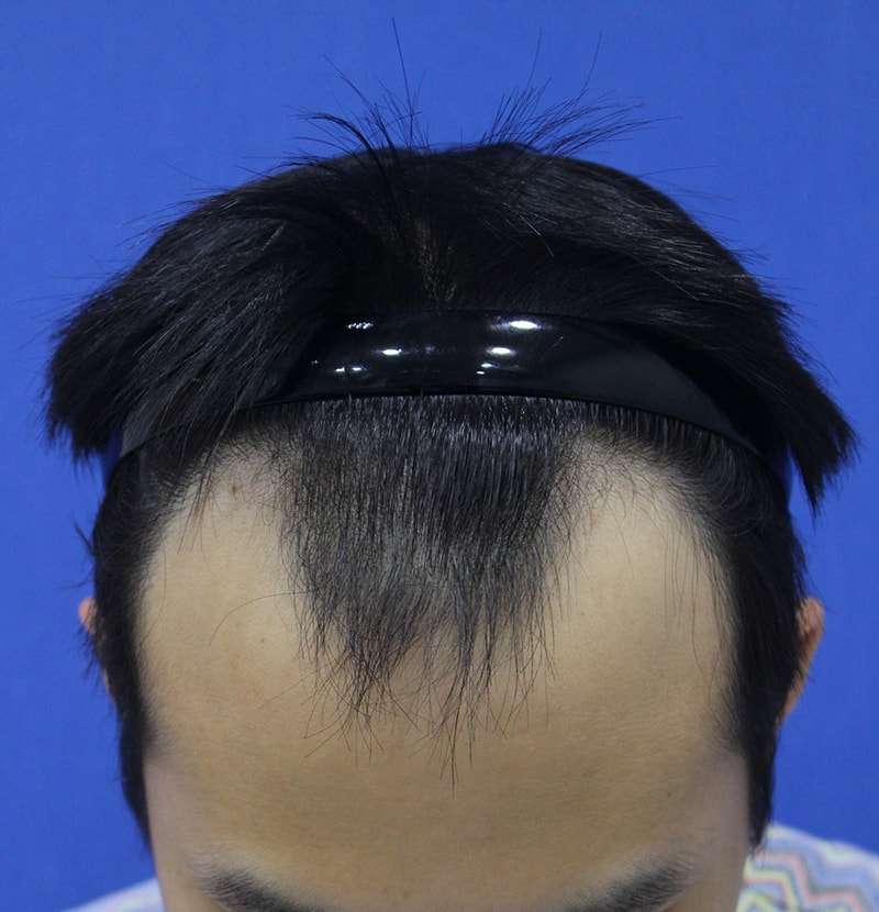 더기덕 (1).jpg