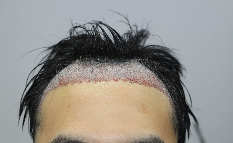더기덕 (3).jpg