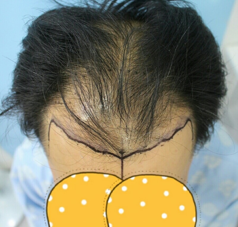 KakaoTalk_20170411_110835626.jpg