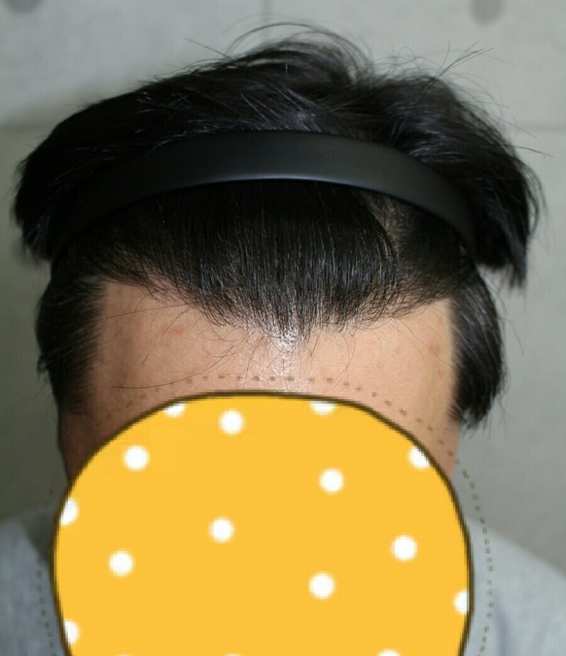 KakaoTalk_20170411_110835064.jpg
