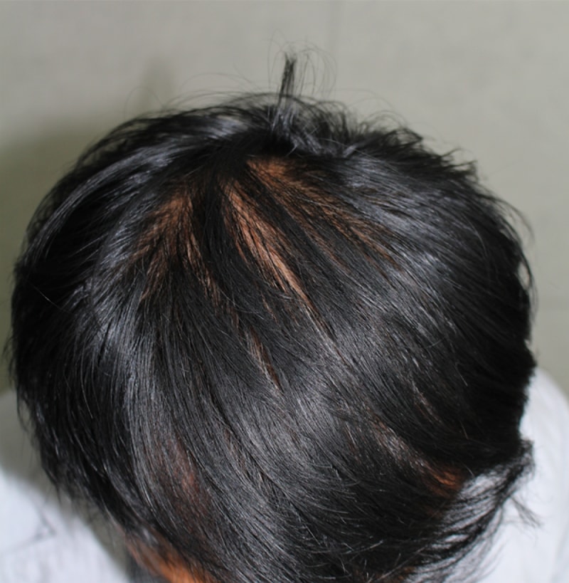 IMG_5673_1년.png