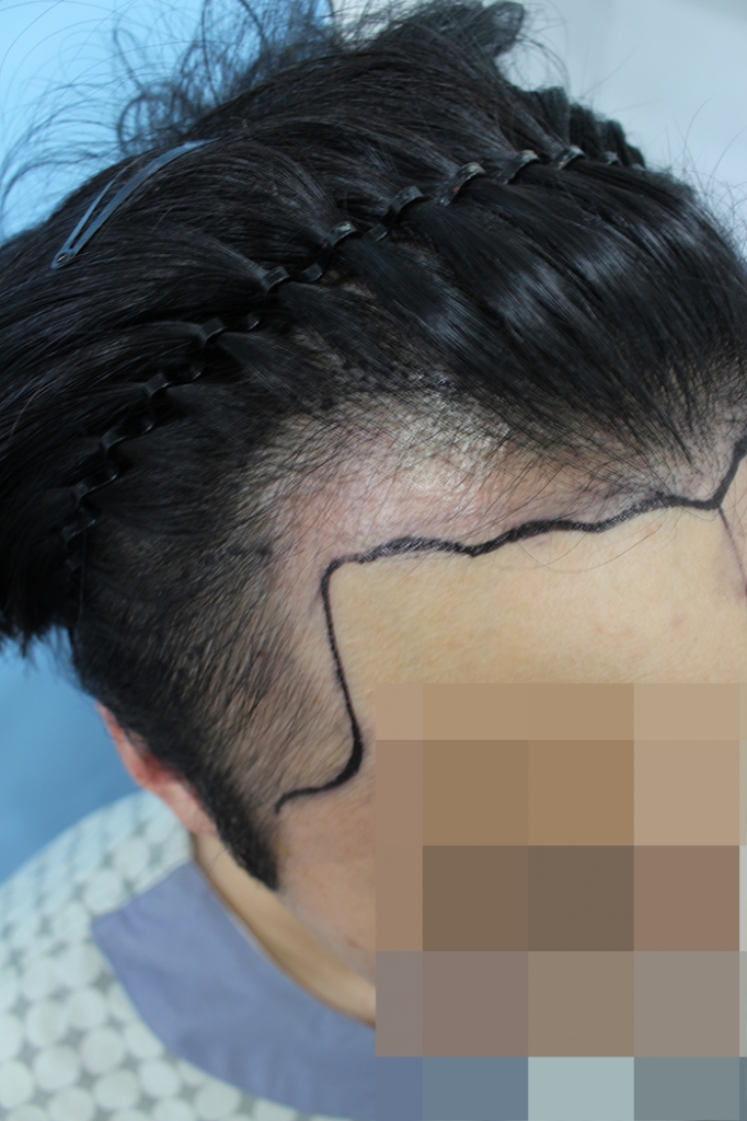 002.png