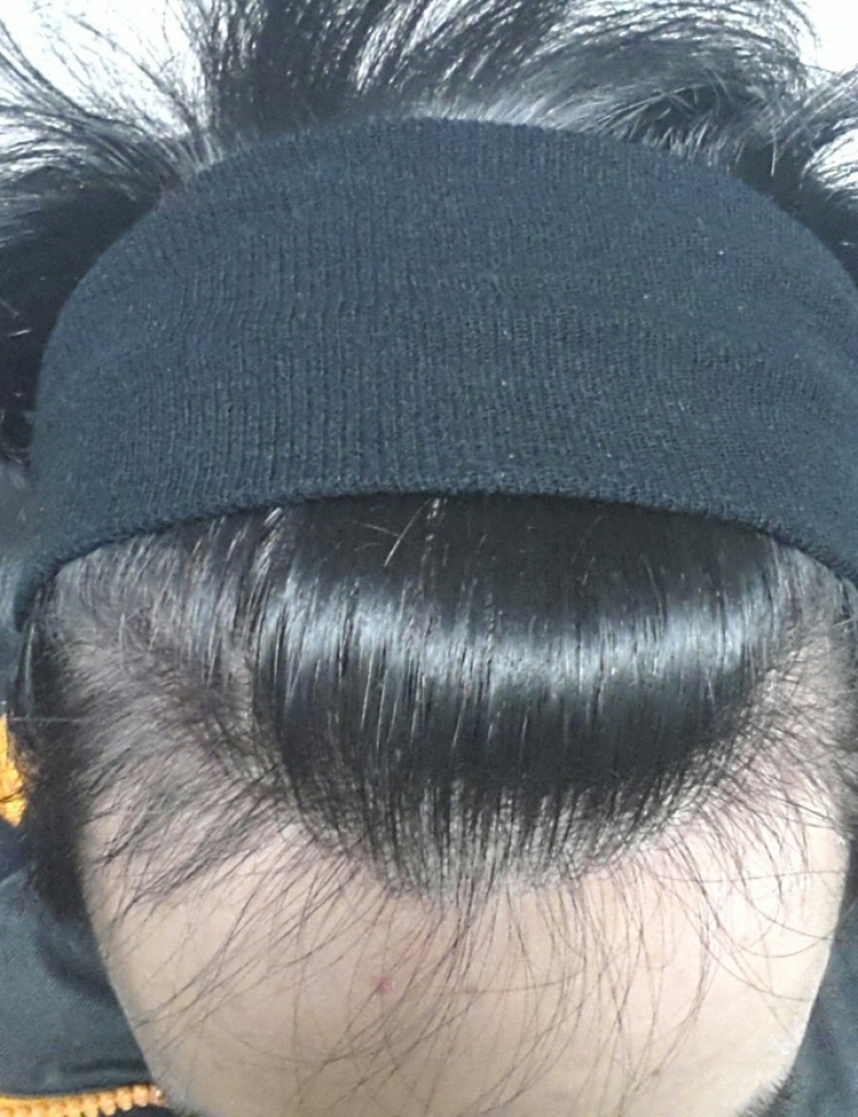 4달 정면.JPG