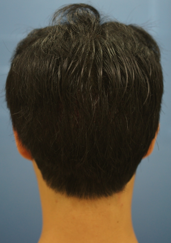 후3.JPG