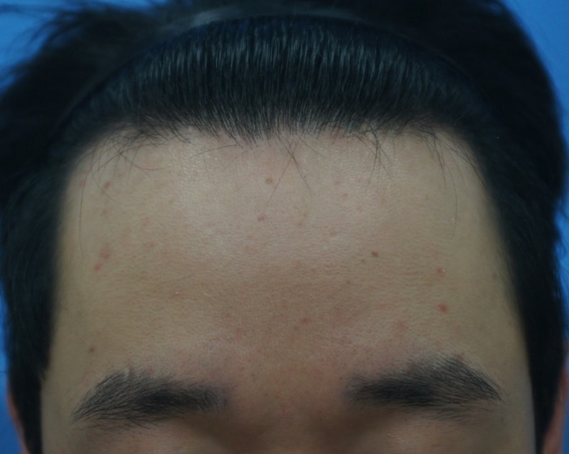 전1.JPG