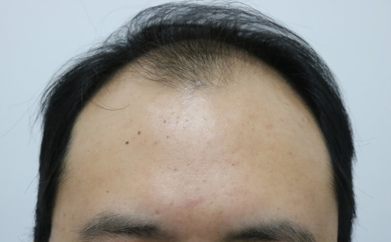 새 삶을 얻었습니다 감사합니다.
