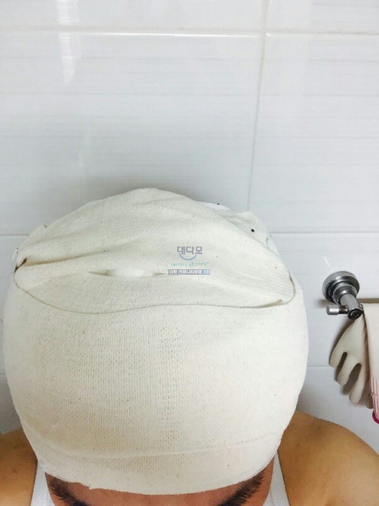 저도 결국 8개월 경과해 갑니다 오랜만에 씁니다