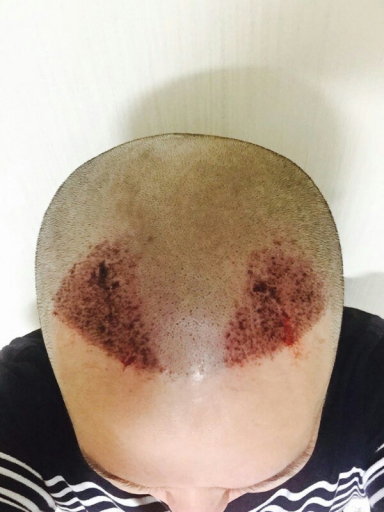 KakaoTalk_20151008_175041176.jpg