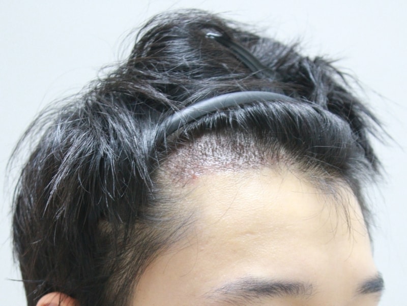3주후2.JPG