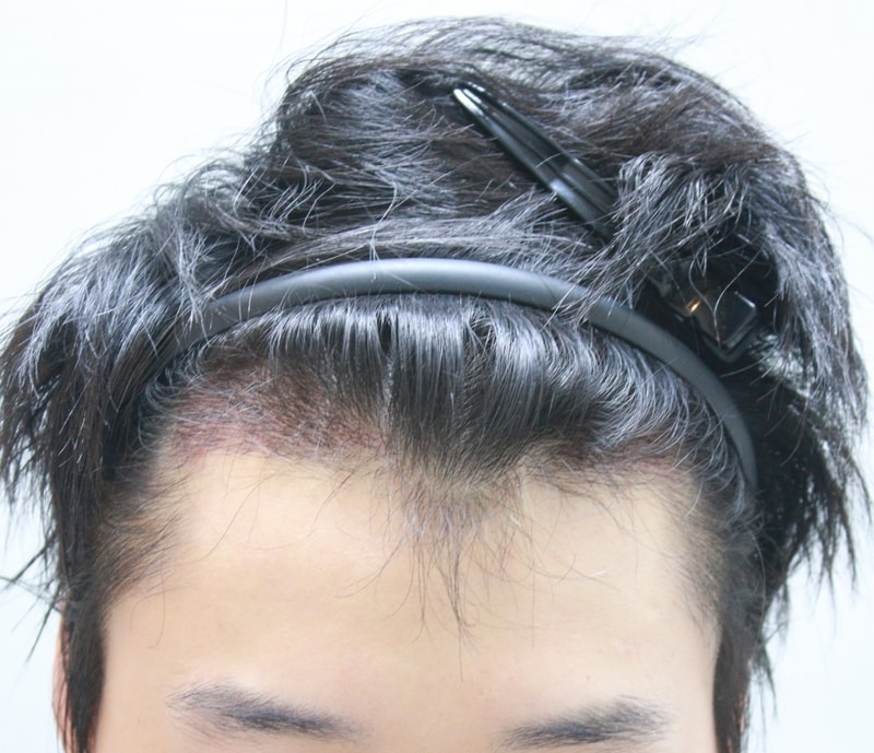 3주후1.JPG