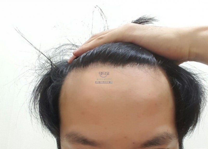 8개월1.jpg