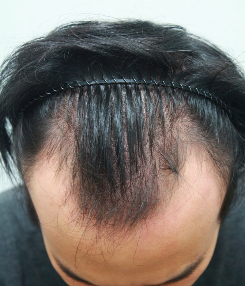 크기변환_수술전1.jpg