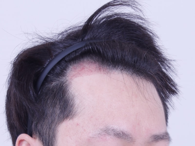 3주3.JPG