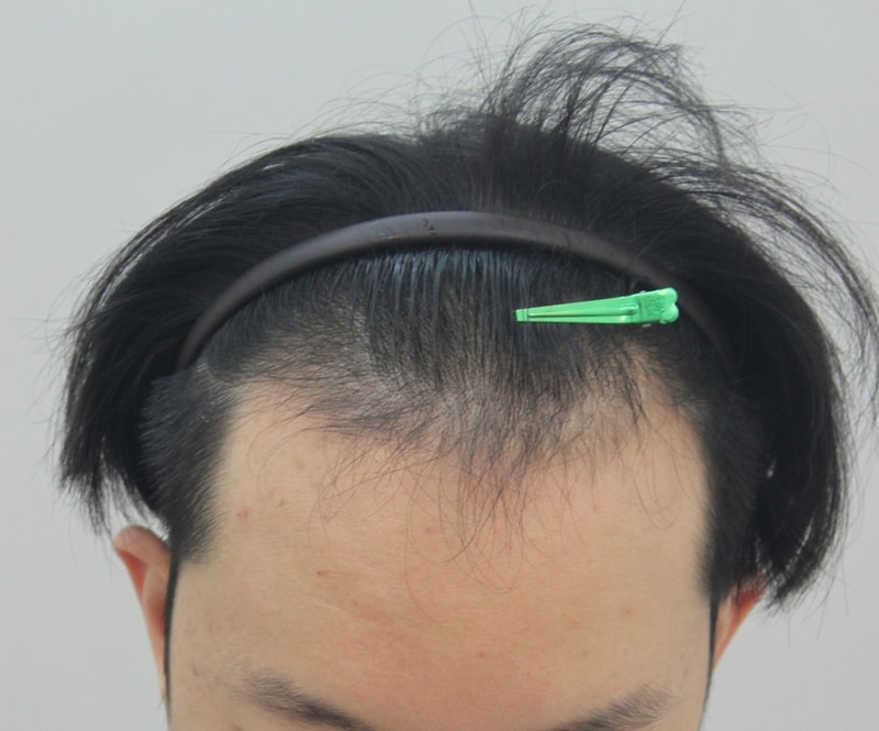 전1.JPG