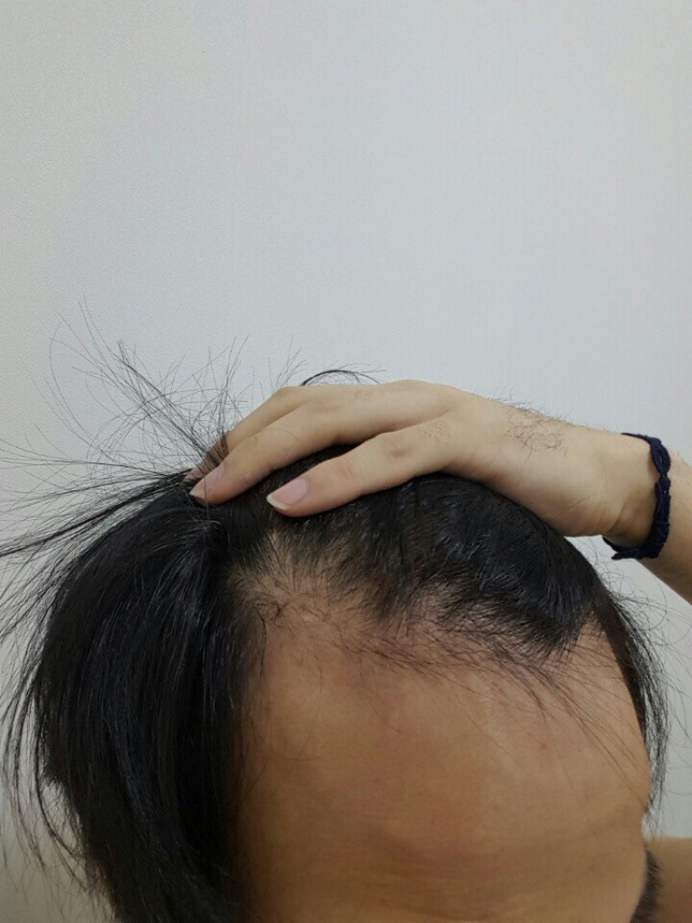 직장인 비삭발이고 최근 사진 찍어올리겠습니다