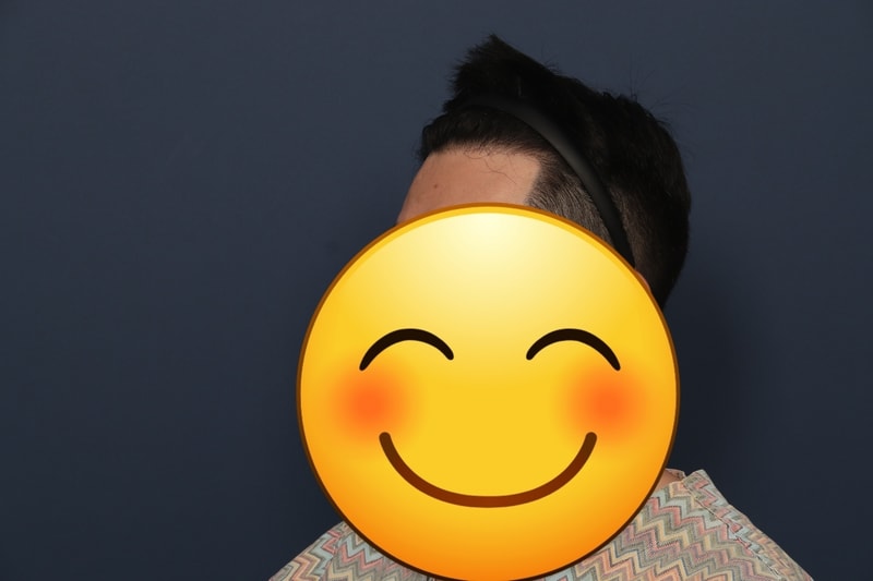 모재성 성형외과 후기