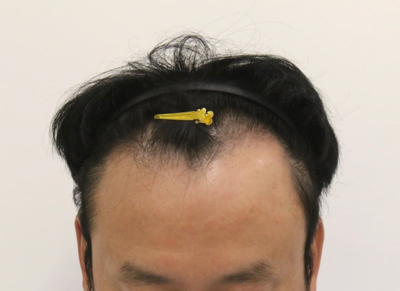 1000487710.jpg