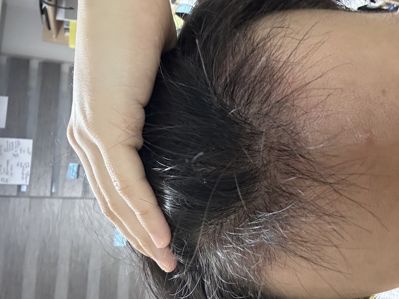 오늘로 100일째 후기입니당!!