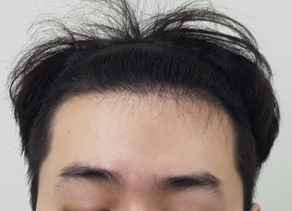 3.png