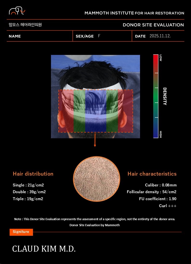 Review on the Day of Hairline Correction in Busan Hair Implant Slit Method Mammoth Hair Restoration Center