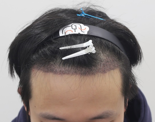 1000001601.jpg