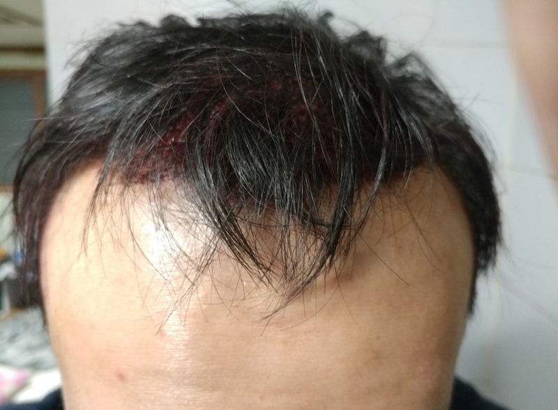 KakaoTalk_20171218_175642447.jpg