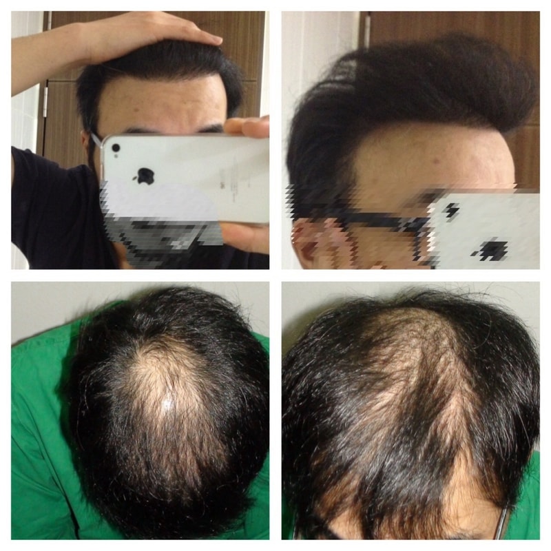 2011년 1차 후 그리고 2015년 2차 하기 전.jpg