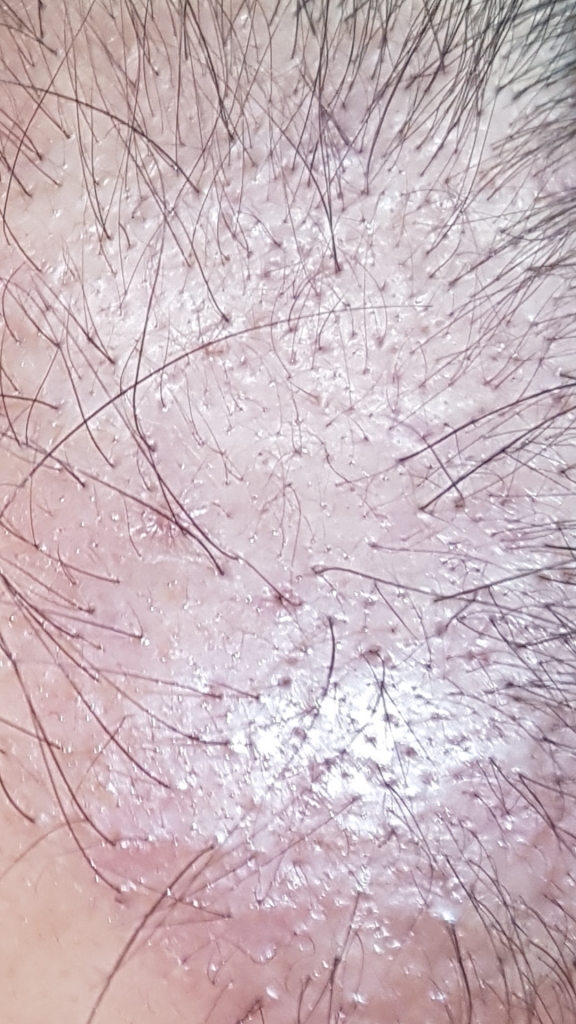 Screenshot_20190322-095359_Gallery.jpg