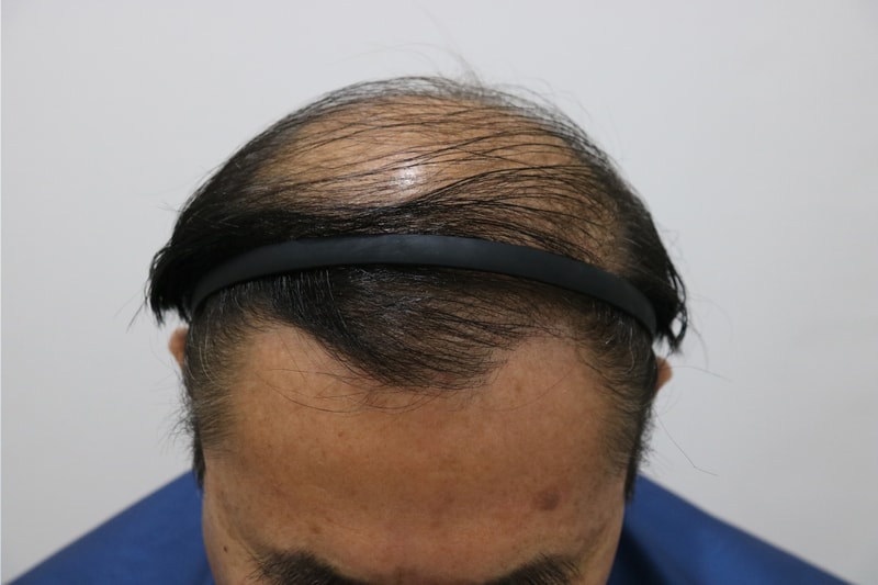 3.JPG