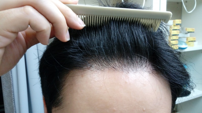 8개월 병원 다녀왔습니다.
