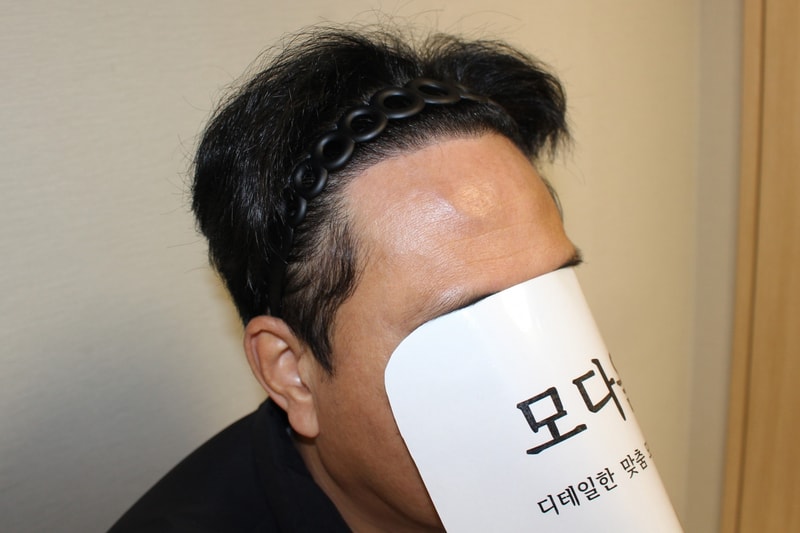 6개월 경과 오른쪽.jpg