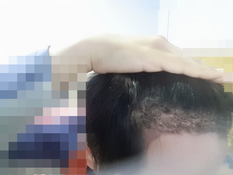 왼(모).jpg