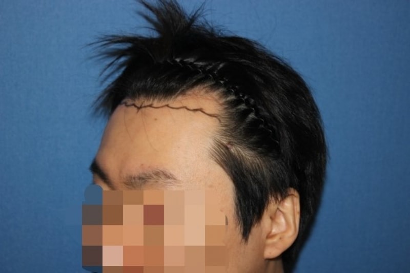수술전1.jpg