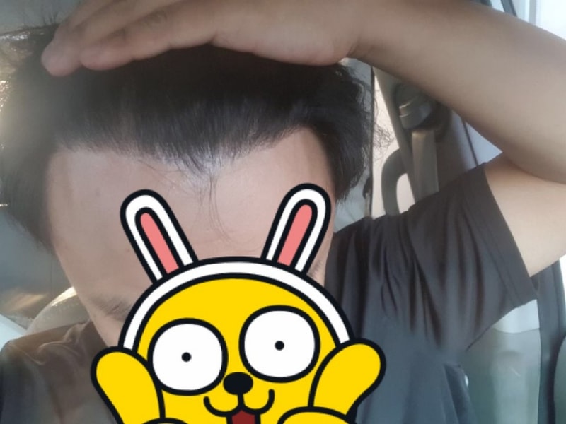 포헤어 9개월 후기