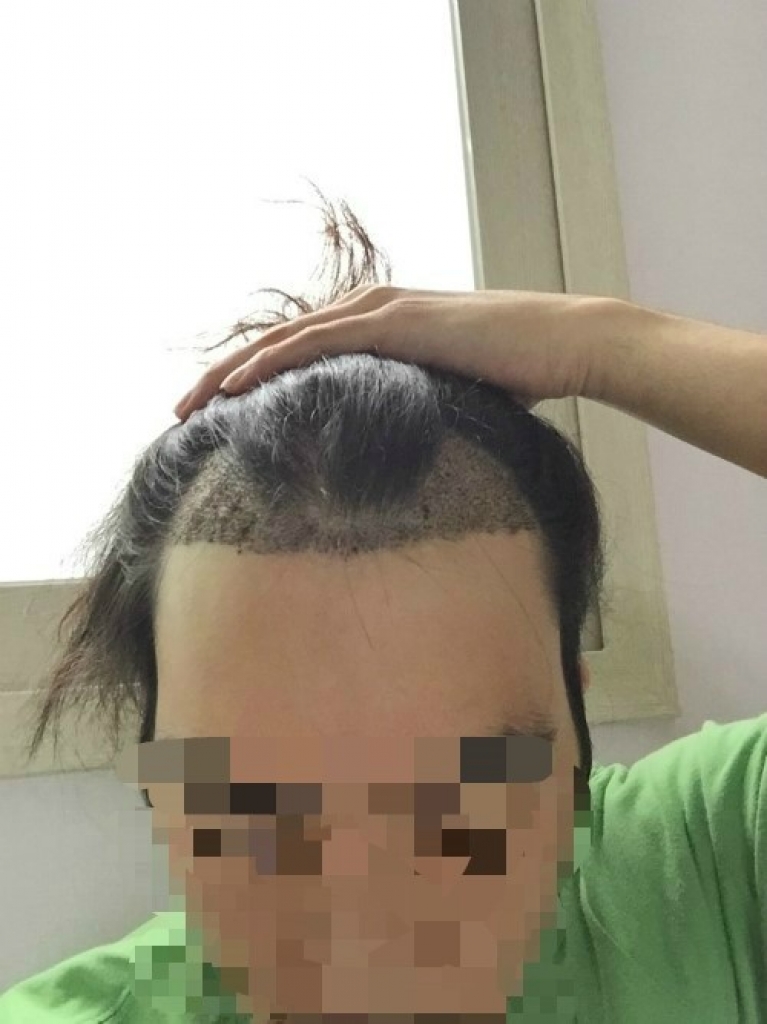 두번째.jpg