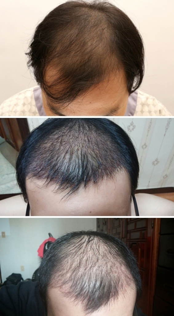 호잇.jpg