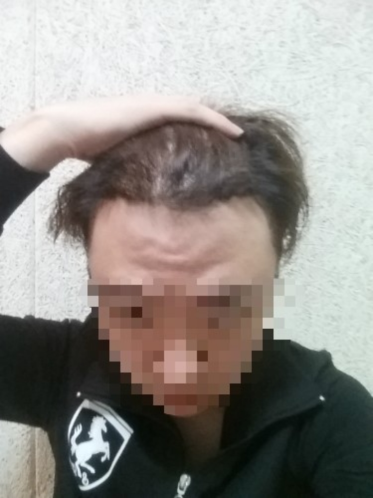 수술후사진1.jpg
