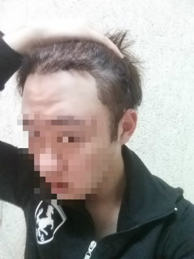 수술후사진2.jpg