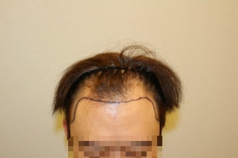 수술전사진2.jpg