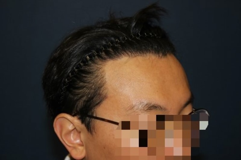수술후1.jpg