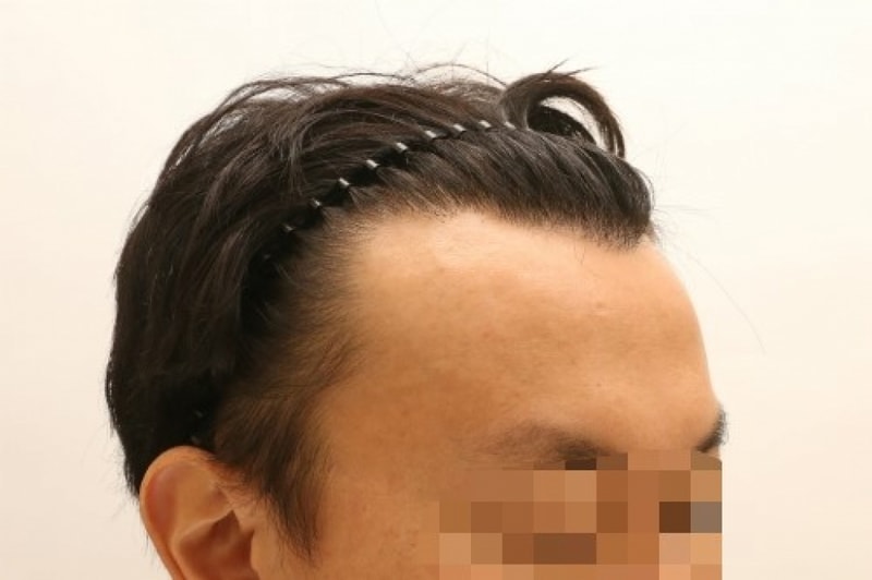 수술전1.jpg