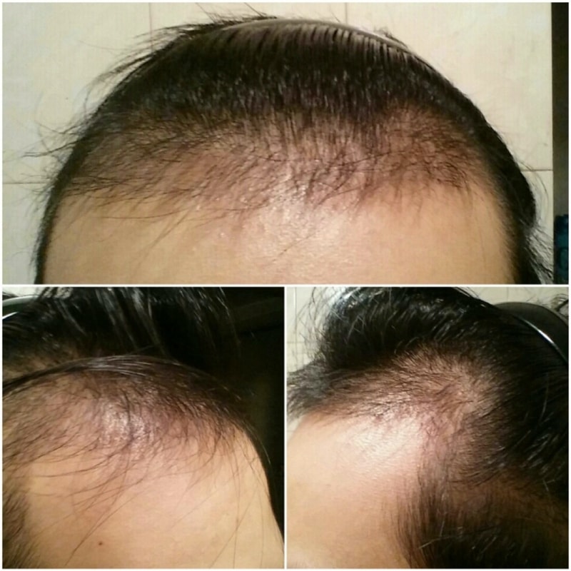 크기변환_PicMonkey Collage.jpg