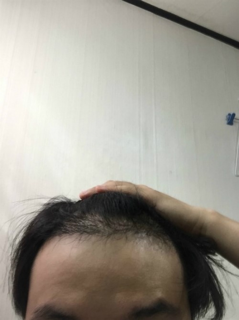 수술후사진2.jpg