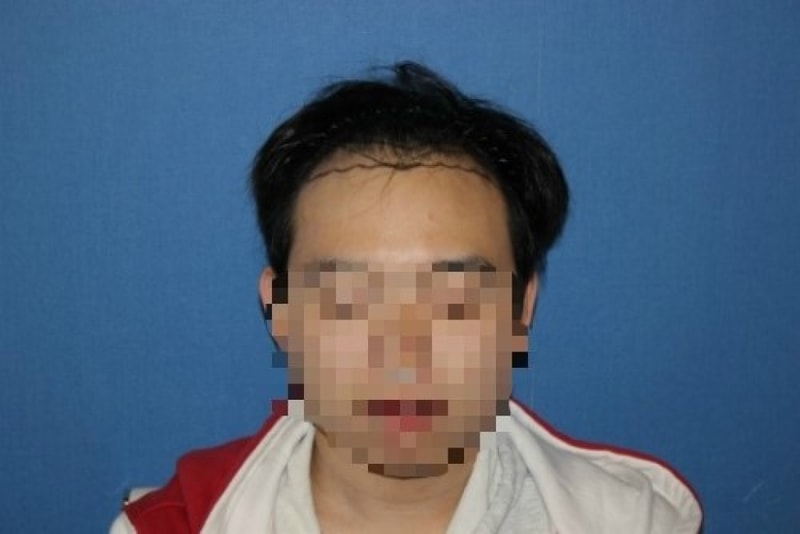 수술하기 전 사진.jpg