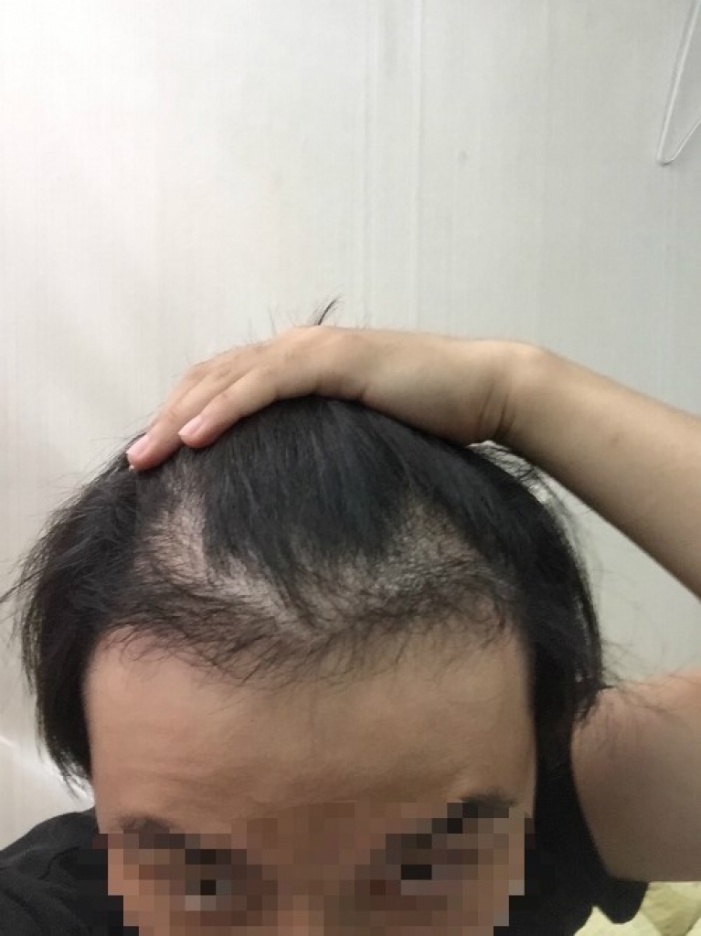 수술후 사진.jpg